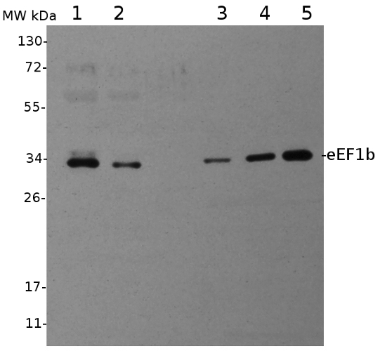 western blot using anti-eEF1b antibodies